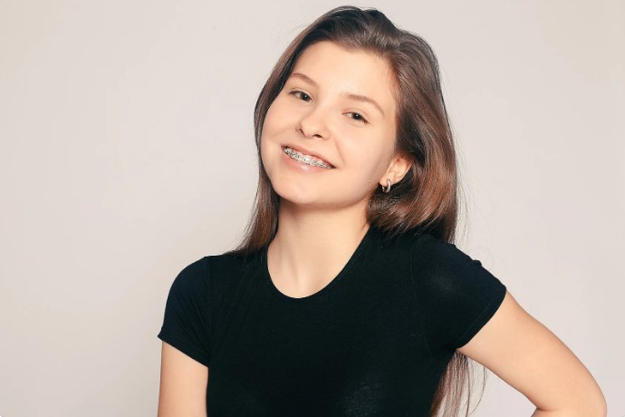 продолжительность ношения брекетов