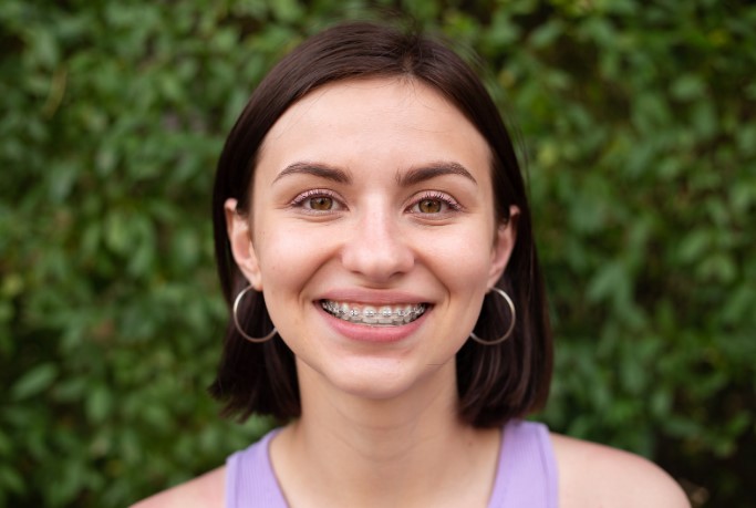 как долго носить брекеты